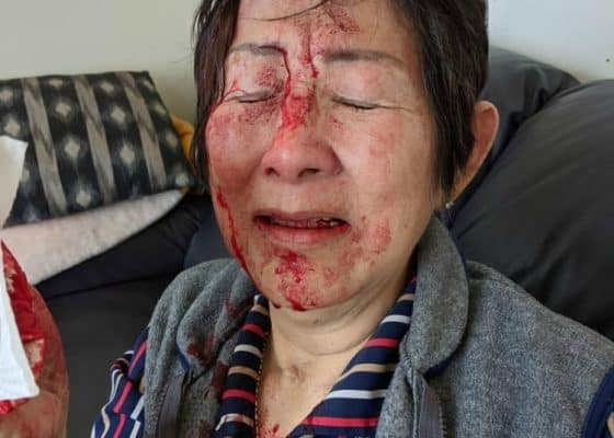 người phụ nữ gốc Việt bị tấn công khi đang ở nhà riêng
